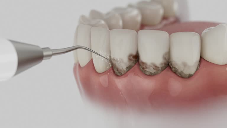 Reliable Dental Implants contractor in Seven Fields, PA by Smile Center Dentistry